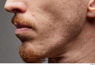 HD Face Skin John Hopkins chin face nose skin pores…
